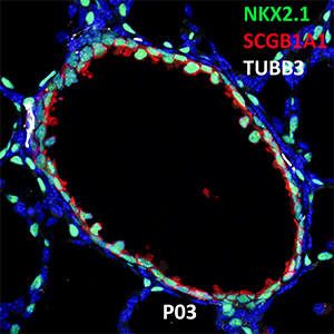 Postnatal Day 03 C57BL6 NKX2.1, SCGB1A1, and TUBB3 Confocal Imaging