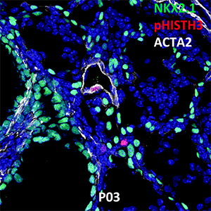 Postnatal Day 03 C57BL6 NKX2.1, pHISTH3, and ACTA2 Confocal Imaging