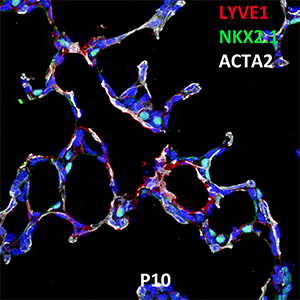 Postnatal Day 10 C57BL6 LYVE1, NKX2.1, and ACTA2 Confocal Imaging
