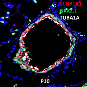 Post Natal Day 10 C57BL6 NKX2.1, SCGB1A1, and TUBA1A Confocal Imaging