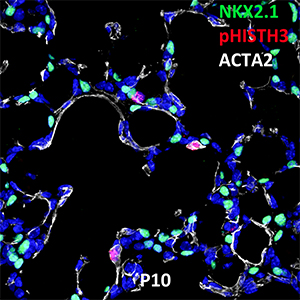Postnatal Day 10 C57BL6 NKX2.1, pHISTH3, and ACTA2 Confocal Imaging