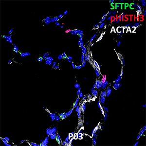 Postnatal Day 03 C57BL6 SFTPC, pHISTH3, and ACTA2 Confocal Imaging
