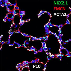 Postnatal Day 10 C57BL6 NKX2.1, EMCN, and ACTA2 Confocal Imaging