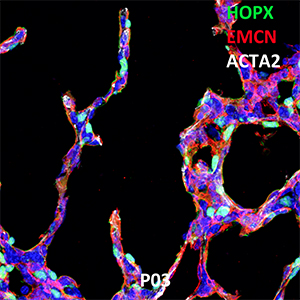 Postnatal Day 03 C57BL6 HOPX, EMCN, and ACTA2 Confocal Imaging