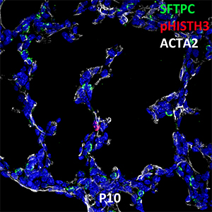 Postnatal Day 10 C57BL6 SFTPC, pHISTH3, and ACTA2 Confocal Imaging