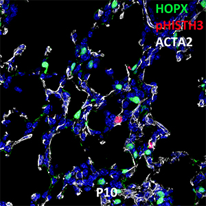Postnatal Day 10 C57BL6 HOPX, pHISTH3, and ACTA2 Confocal Imaging