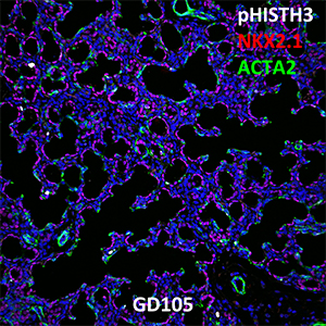 Gestational Day 105 Fetal Monkey pHISTH3, NKX2.1, and ACTA2 Confocal Imaging