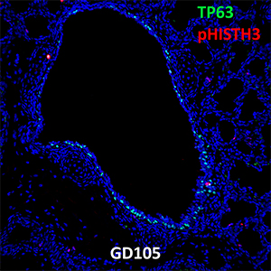 Gestational Day 105 Fetal Monkey TP63 and pHISTH3 Confocal Imaging