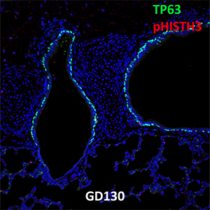Gestational Day 130 Fetal Monkey TP63 and pHISTH3 Confocal Imaging