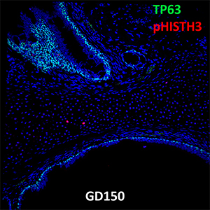 Gestational Day 150 Fetal Monkey TP63 and pHISTH3 Confocal Imaging