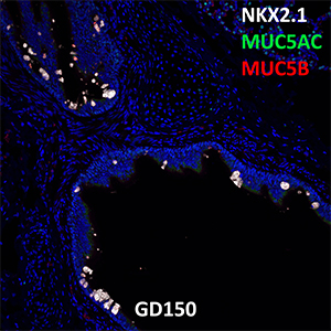 Gestational Day 150 Fetal Monkey NKX2.1, MUC5AC, and MUC5B Confocal Imaging