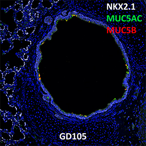 Gestational Day 105 Fetal Monkey NKX2.1, MUC5AC, and MUC5B Confocal Imaging