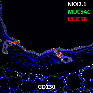 Gestational Day 130 Fetal Monkey NKX2.1, MUC5AC, and MUC5B Confocal Imaging