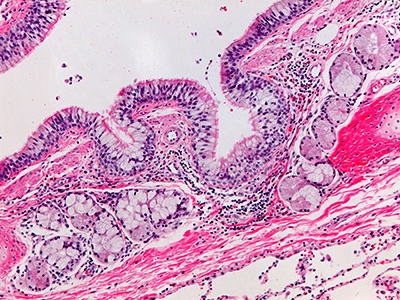 H&E Staining of 2 Year Old Human Lung D022-RLL-6B2.14