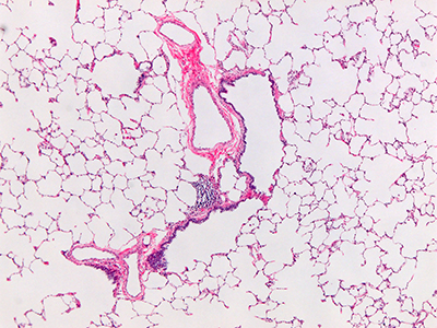 H&E Staining of 3 Year Old Human Lung D032-RLL-4A2.13