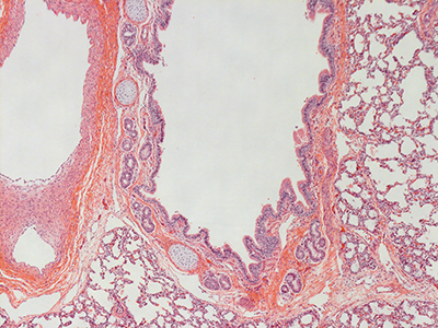 H&E Staining of 1 Day Human Lung D038-RLL-7A1