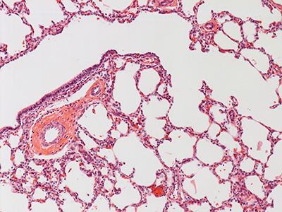 H&E Staining of 1 Day Human Lung D038-RLL-7A2