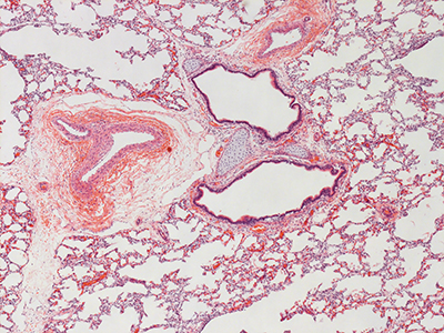 H&E Staining of 1 Day Human Lung D019-RLL-3B1