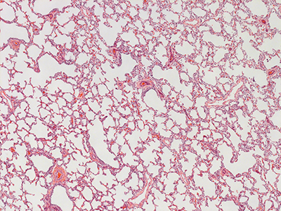 H&E Staining of 1 Day Human Lung D038-RLL-9A2