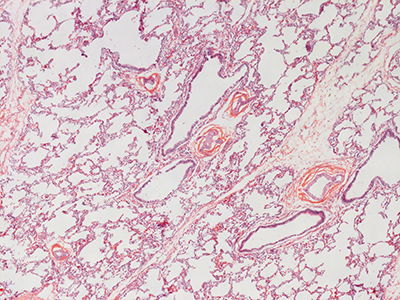 H&E Staining of 1 Day Human Lung D038-LLL-8A2.16