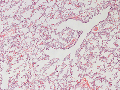 H&E Staining of 1 Day Human Lung D038-LLL-8A2.25