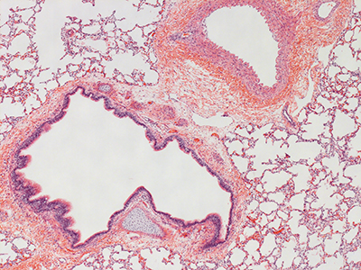 H&E Staining of 1 Day Human Lung D019-RLL-6A2