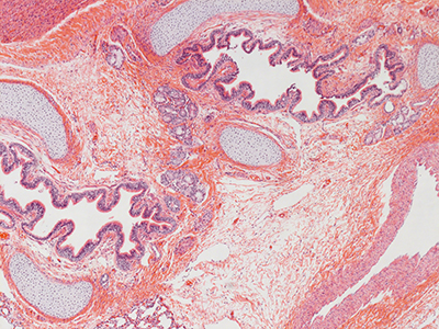 H&E Staining of 1 Day Human Lung D019-RLL-5B1