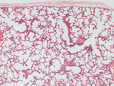 H&E Staining of 1 Day Human Lung D038-RLL-6A2