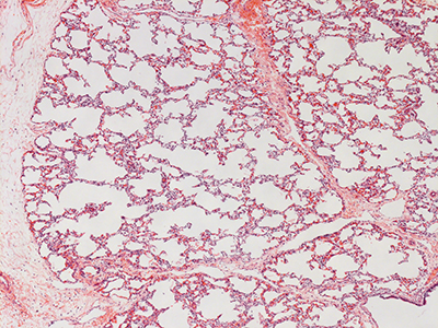 H&E Staining of 1 Day Human Lung D019-RLL-4B1