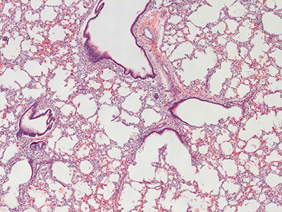 H&E Staining of 1 Day Human Lung D019-RLL-5A1