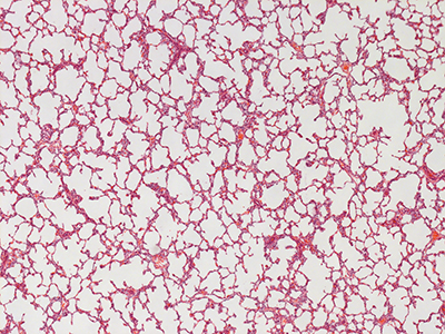 H&E Staining of 1 Day Human Lung D038-RLL-9A1