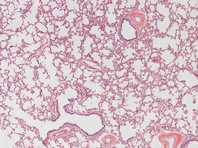 H&E Staining of 1 Day Human Lung D038-RLL-6B2