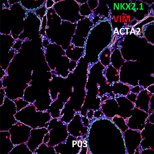 Postnatal Day 3 C57BL6 NKX2.1, VIM, and ACTA2 Confocal Imaging