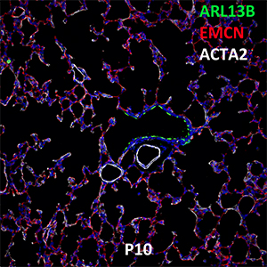 Postnatal 10 C57BL6 ARL13B, EMCN, and ACTA2 Confocal Imaging