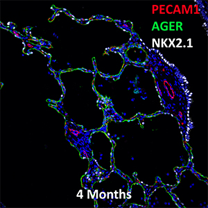 4 Month Human Lung PECAM-1, AGER, and NKX2.1 Confocal Imaging