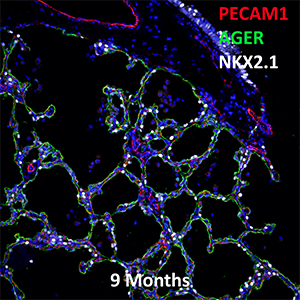 9 Month Human Lung PECAM-1, AGER, and NXK2.1 Confocal Imaging