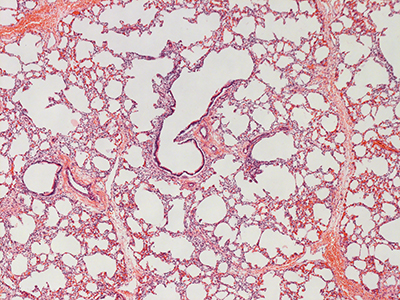 H&E Staining of 1 Day Human Lung D019-RLL-6A1