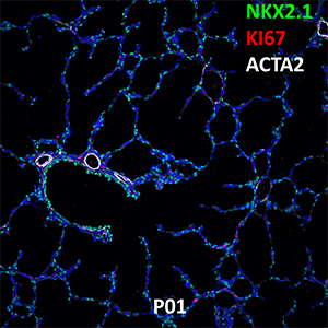 P01 C57BL6 NKX2.1, KI67, and ACTA2 Confocal Imaging