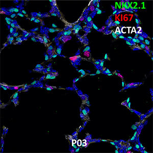 P03 C57BL6 NKX2.1, KI67, and ACTA2 Confocal Imaging