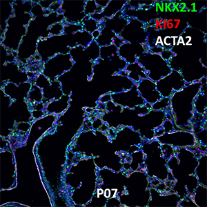 P07 C57BL6 NKX2.1, KI67, and ACTA2 Confocal Imaging