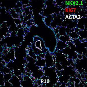 P10 C57BL6 NKX2.1, KI67, and ACTA2 Confocal Imaging