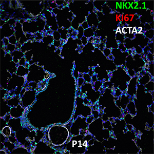 P14 C57BL6 NKX2.1, KI67, and ACTA2 Confocal Imaging