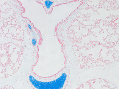 Alcian Blue Staining of 1 Day Human Lung D019-RLL-4B1