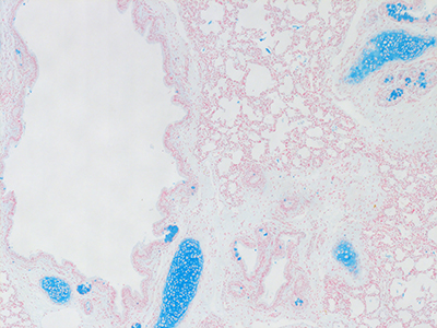 Alcian Blue Staining of 1 Day Human Lung D038-RLL-7A1