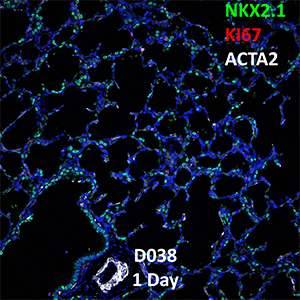 1 Day-Old Human Lung NKX2.1, KI67, and ACTA2 Confocal Imaging