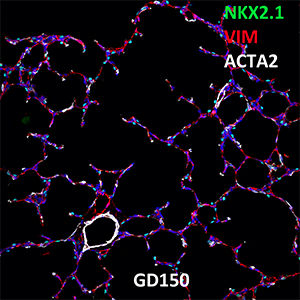 Gestational Day 150 Fetal Monkey NKX2.1, VIM, and ACTA2 Confocal Imaging
