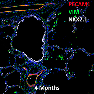 4 Month Human Lung PECAM-1, VIM, and NKX2.1 Confocal Imaging