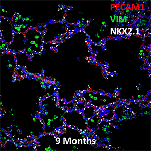 9 Month Human Lung PECAM-1, VIM, and NKX2.1 Confocal Imaging