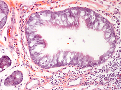 H&E Staining of a 2 year-old human lung Donor D022-LLL-4B2.13