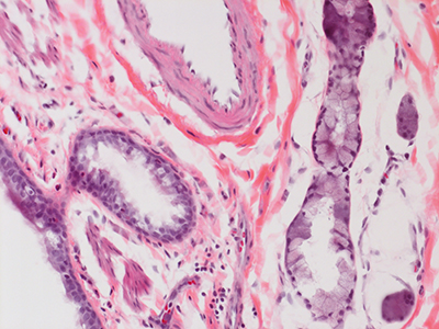 H&E Staining of a 3 Year-Old Human Lung D032-LLL-8B2.41